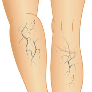 北千住静脈瘤クリニック 下肢静脈瘤治療の外科クリニック